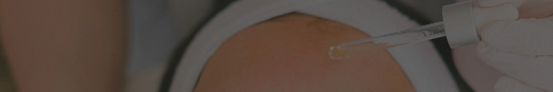 Peeling facial em Jacarezinho